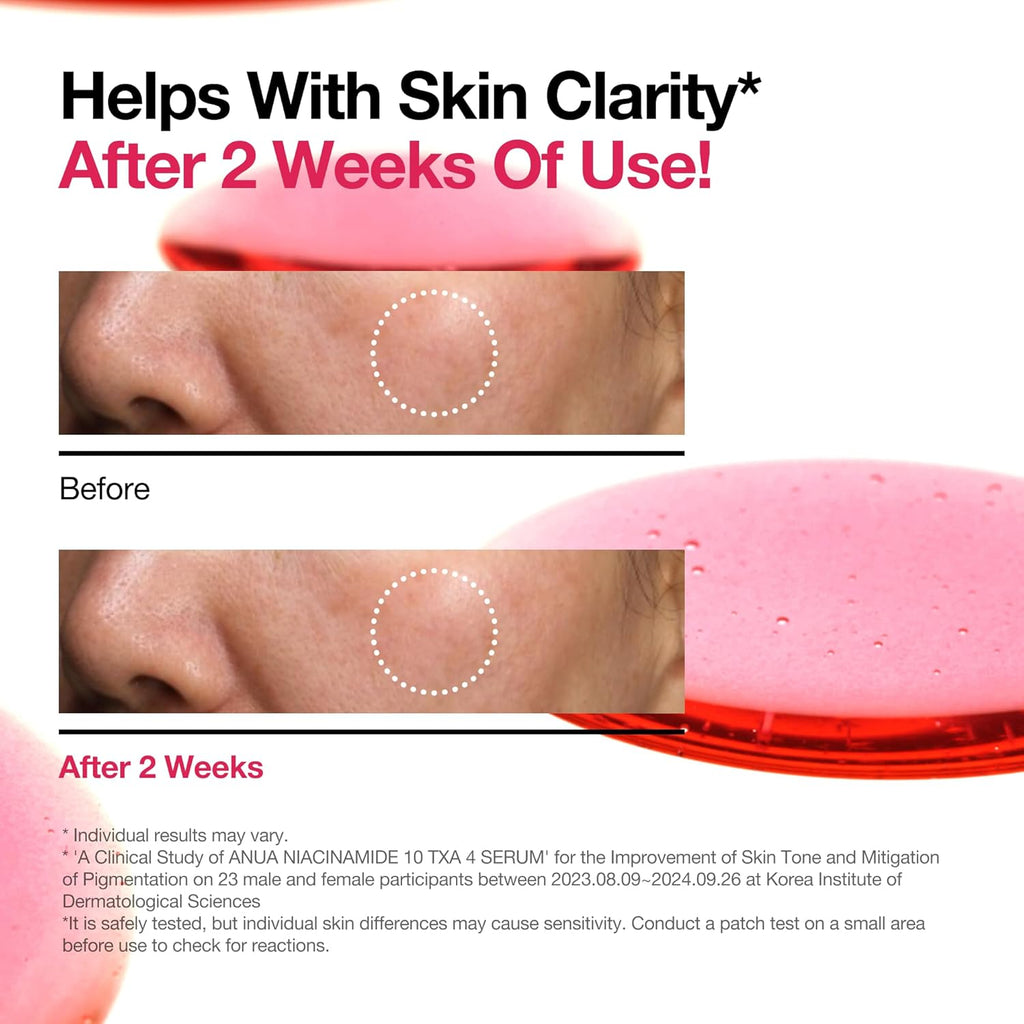Niacinamide 10 TXA 4 Serum for Brightening and Dark Spots