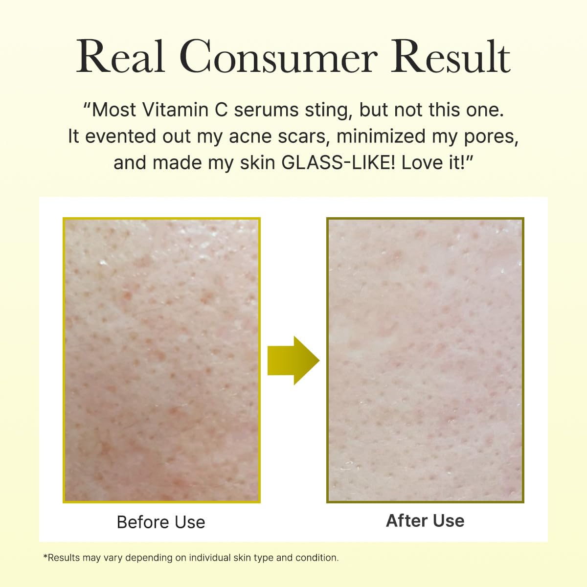 Arencia Vitamin C Booster Serum with Glutathione, Niacinamide, and Vitamin E 30mL | Korean Cosmetics | Skincare Serum | Improves Skin Tone and Radiance