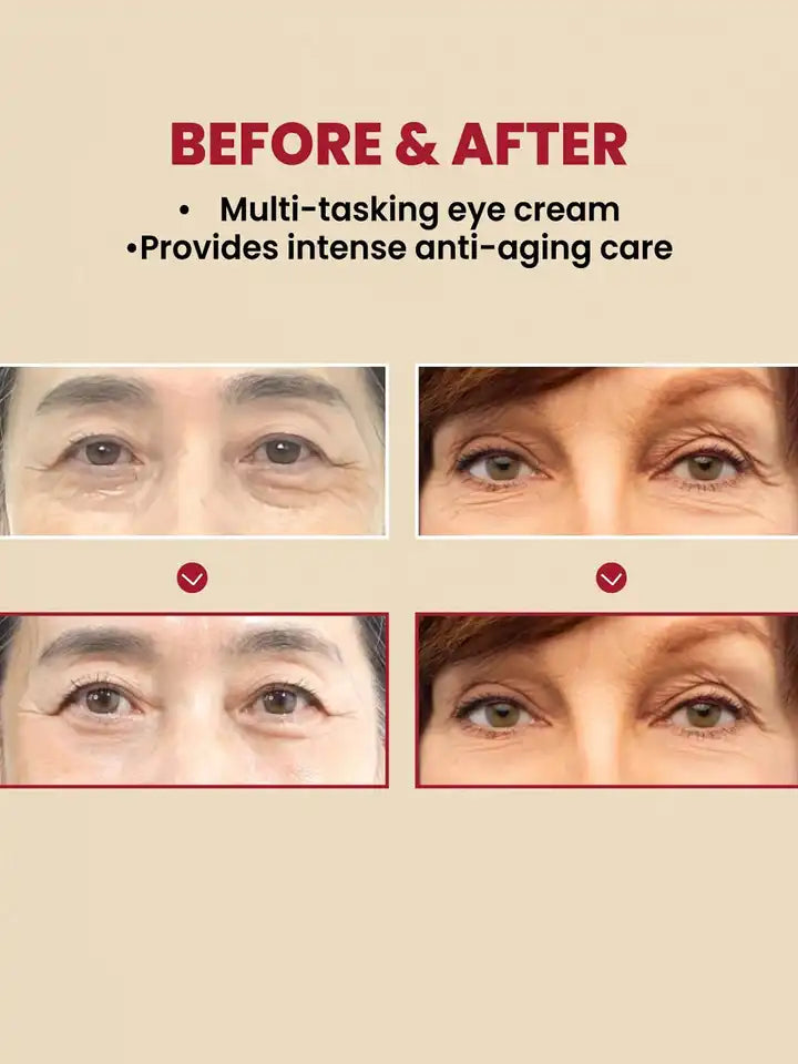 K-SECRET SEOUL 1988 Eye Cream : Retinal Liposome 4% + Fermented Bean, wrinkle care, anti-aging, skin elasticity, pigmentation, brightening, retinol, 30ml/1.01 fl.oz.