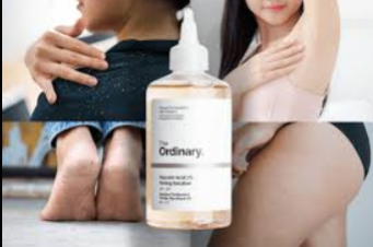 The Ordinary Glycolic Acid 7% Exfoliating Toner (240 ml) For Broken and Inflammed Skin, Bad Odour - Darker Underarms and Dandruff free Scalp